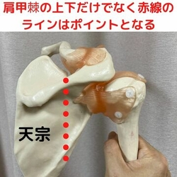 骨模型　