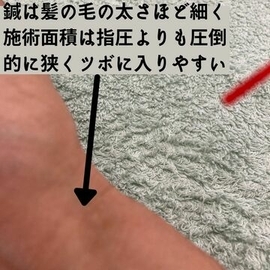 指圧　鍼灸