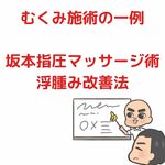 難治性の「足のむくみ」を改善！関節可動域と筋ポンプ作用に注目した施術法